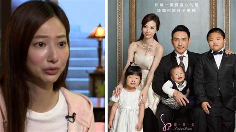 Model gets surgery because family said she looked .